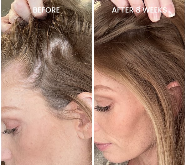 Before and after thicker ponytail results after 8 weeks