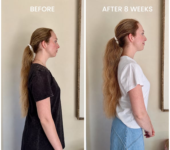 Before and after baby hairs along hairline after 8 weeks